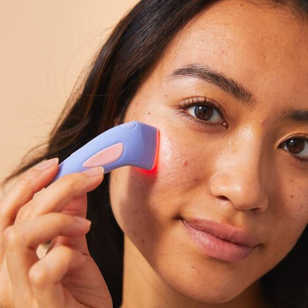 Red Light Acne Remover