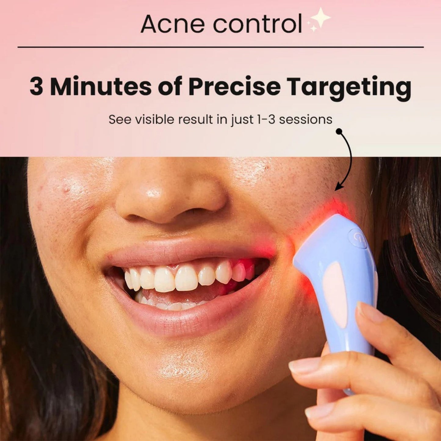 Red Light Acne Remover